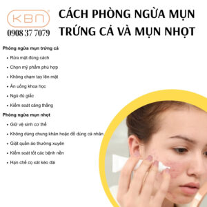 cach-dieu-tri-mun-nhot-va-mun-trung-ca