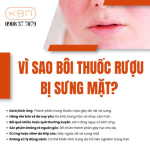 cach-giam-sung-mat-khi-boi-thuoc-ruou