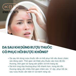 cach-giam-sung-mat-khi-boi-thuoc-ruou