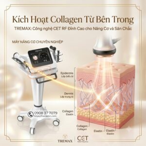 cong-nghe-cet-radio-frequency