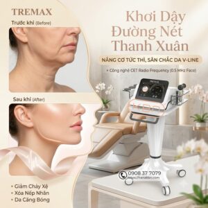 may-tremax-cet