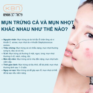 mun-trung-ca-va-mun-nhot-khac-nhau-nhu-the-nao