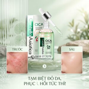 phuc-hoi-da-sau-thuoc-ruou