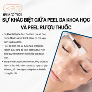 ruou-thuoc-peel-da