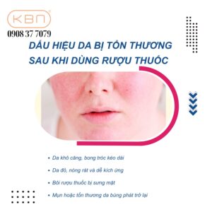 san-pham-phuc-hoi-da-sau-khi-dung-ruou-thuoc