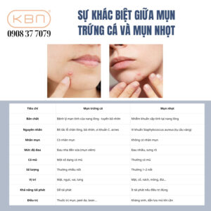su-khac-biet-giua-mun-trung-ca-va-mun-nhot