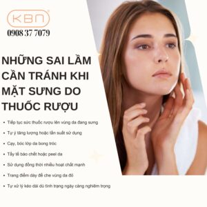 sung-mat-khi-uong-ruou