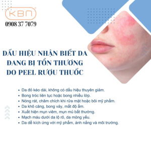 thuoc-ruou-peel-da