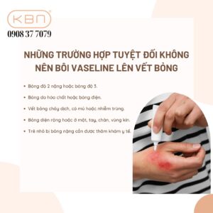 bi-bong-nhe-boi-vaseline-duoc-khong