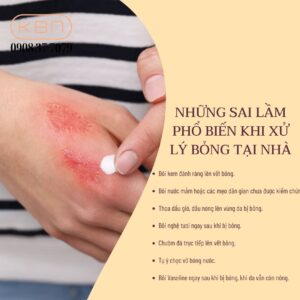 bi-bong-nuoc-soi-boi-vaseline-duoc-khong