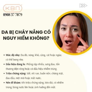 da-bi-chay-nang-co-nguy-hiem-khong