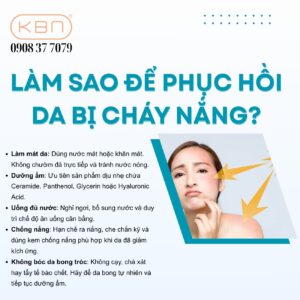 lam-sao-de-phuc-hoi-da-bi-chay-nang