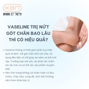 nut-got-chan-boi-vaseline-duoc-khong