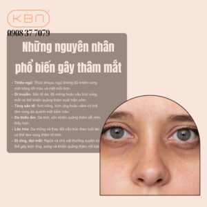 vaseline-co-tri-tham-mat