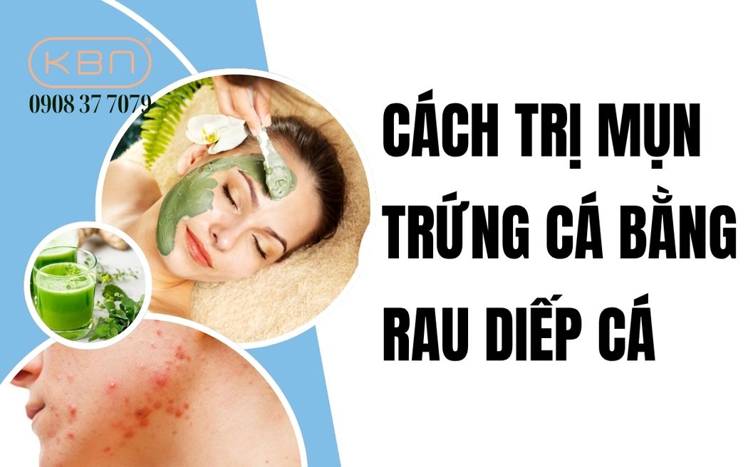 7 cách trị mụn trứng cá bằng rau diếp cá