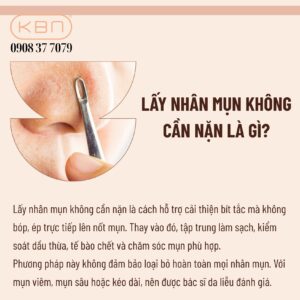 cach-lay-nhan-mun-khong-can-nan