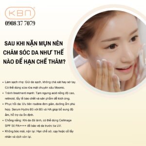 hut-mau-bam-mun-co-tot-khong