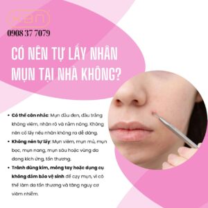 lam-the-nao-de-lay-nhan-mun-dung-cach