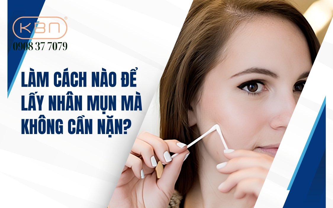 Cách lấy nhân mụn không cần nặn an toàn, hiệu quả