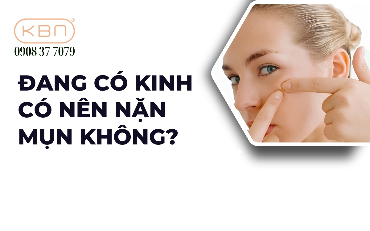 Đang có kinh có nên nặn mụn không?