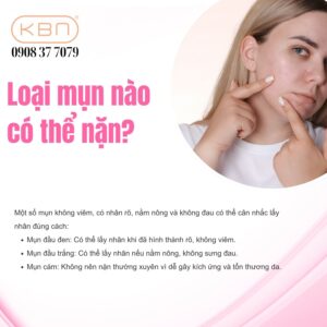 loai-mun-nao-co-the-nan
