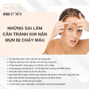 mun-bi-chay-mau-nen-lam-gi