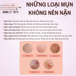 mun-nao-khong-nen-nan