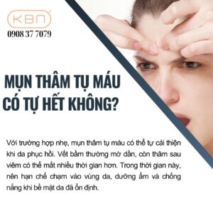 mun-tham-tu-mau-co-tu-het-khong