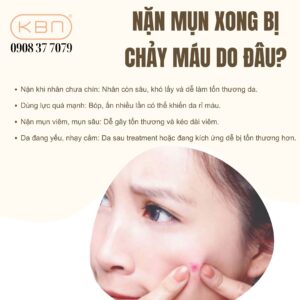 nan-mun-chay-mau-phai-lam-gi