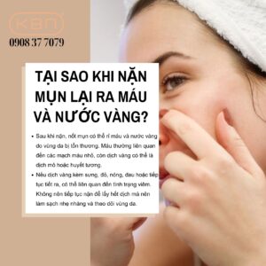 tai-sao-khi-nan-mun-lai-ra-mau-va-nuoc-vang