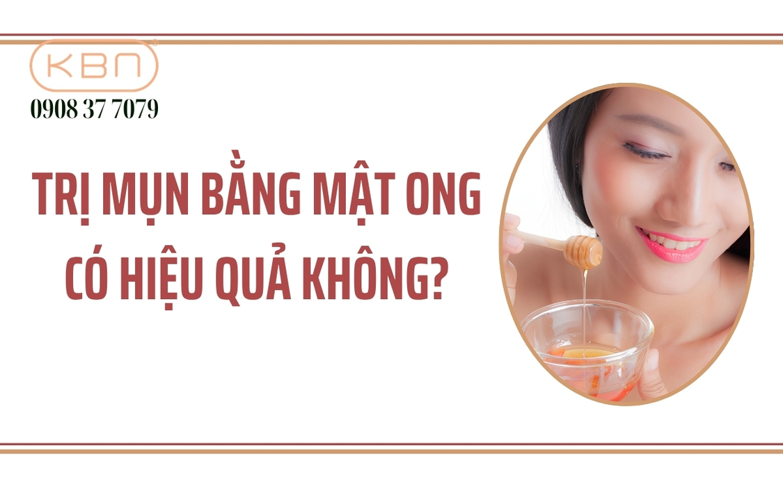 Trị mụn bằng mật ong có tốt không?